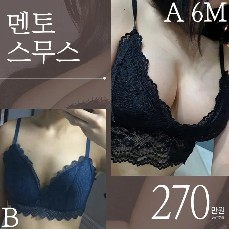 ♥멘토스무스 가슴성형♥ 이벤트 썸네일 이미지