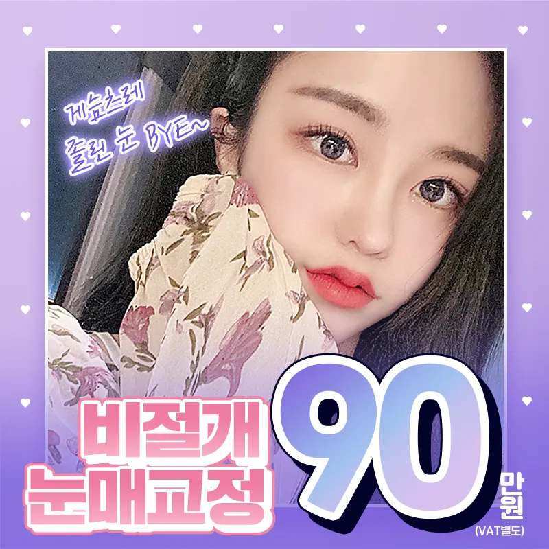 디데이💖비절개눈매교정 이벤트 썸네일 이미지