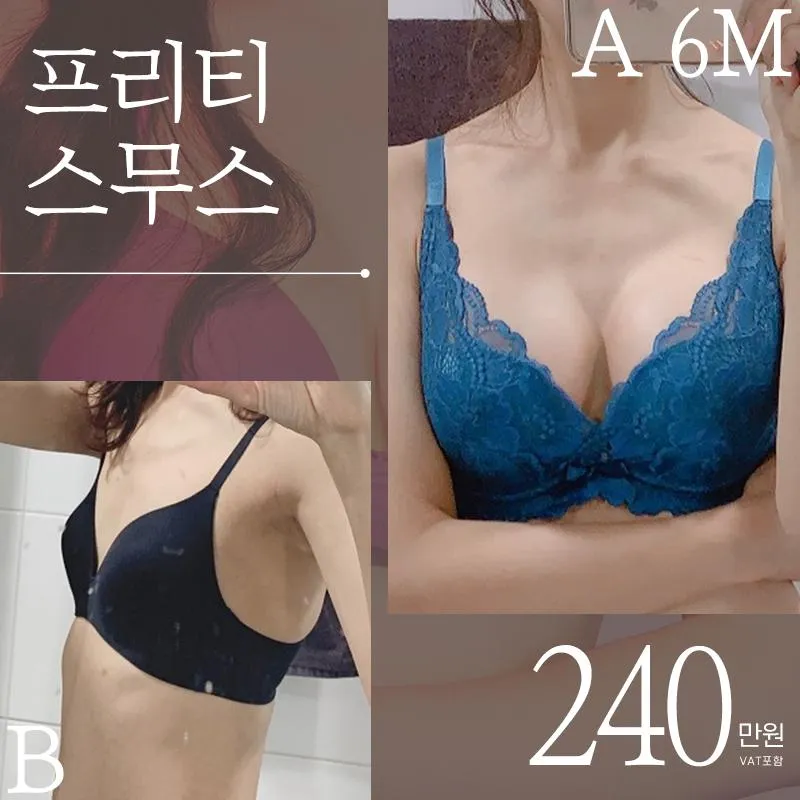 ♥프리티 스무스가슴성형♥ 이벤트 썸네일 이미지
