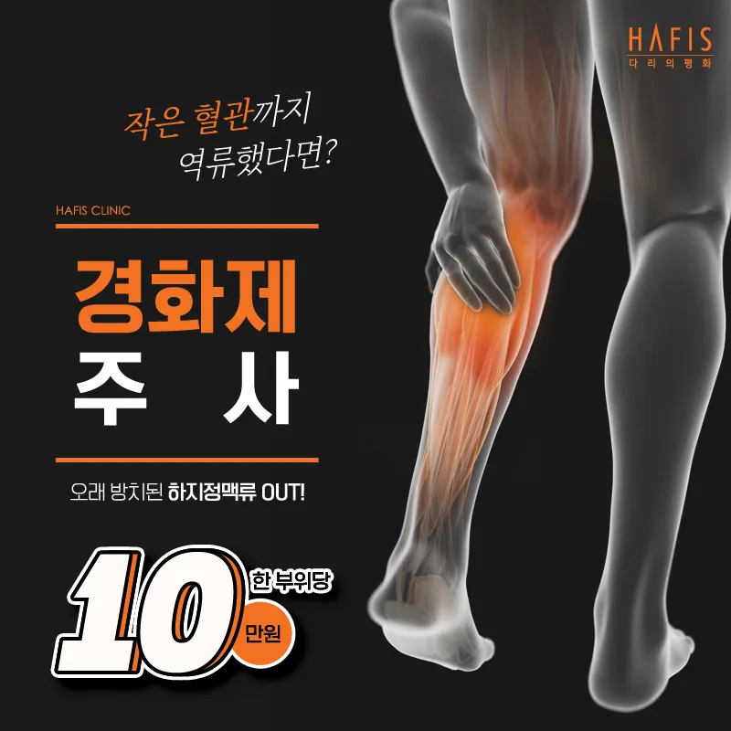 하지정맥 경화제주사(한 부위당) 이벤트 썸네일 이미지