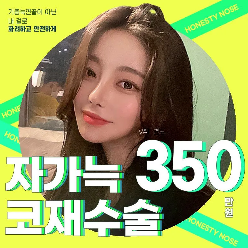 ⭐자가늑코재수술⭐ 이벤트 썸네일 이미지