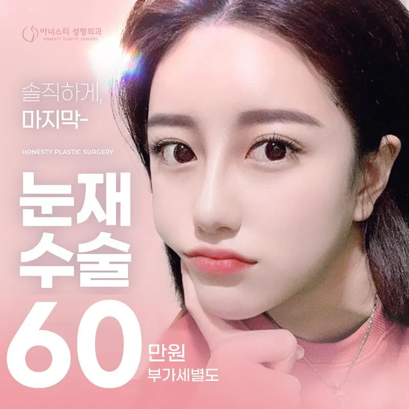 마지막 눈 재수술💟 이벤트 썸네일 이미지