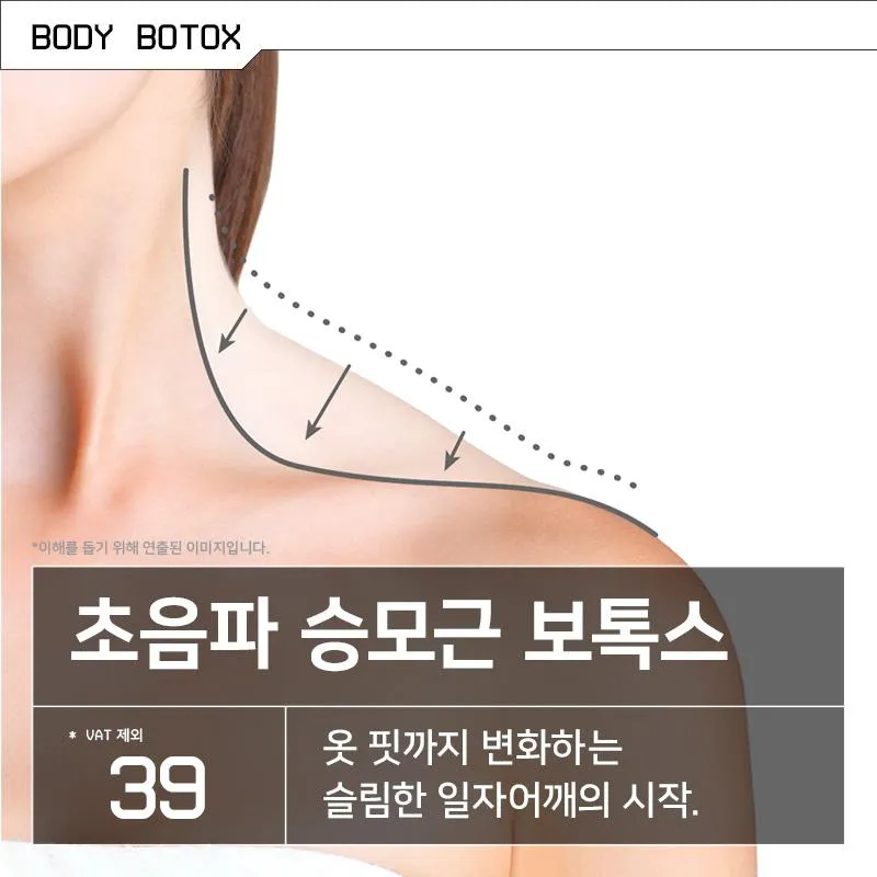 초음파 승모근 보톡스 이벤트 썸네일 이미지