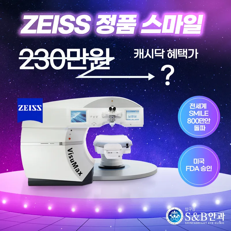 [정품] 자이스 스마일라식 할인 이벤 이벤트 썸네일 이미지