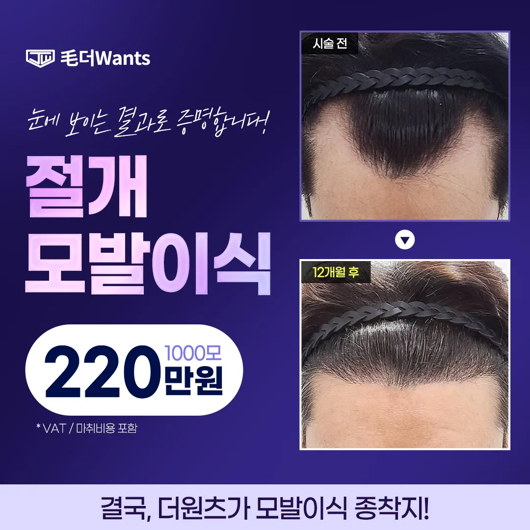 자연스러운 절개 모발이식 1000모 이벤트 썸네일 이미지
