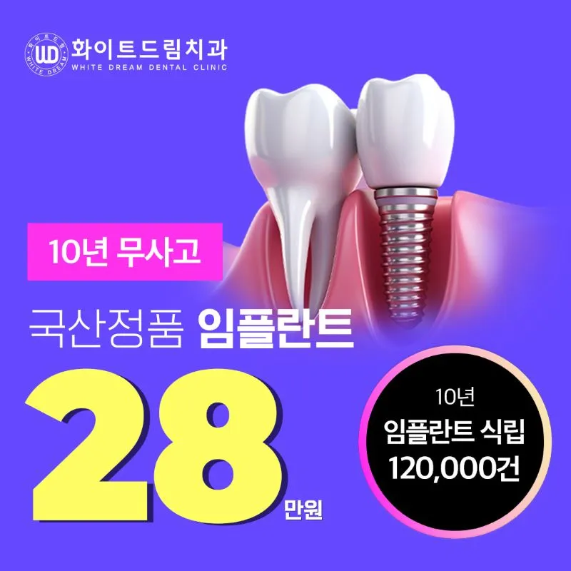 당일식립 합리적인 임플란트 28만원 이벤트 썸네일 이미지