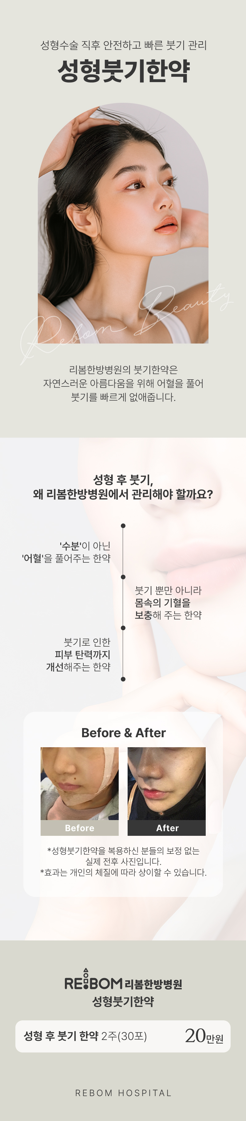 리봄한방병원 대구점 리봄 대구❤️성형붓기한약 2주❤️ 이벤트, 시술 상세 이미지