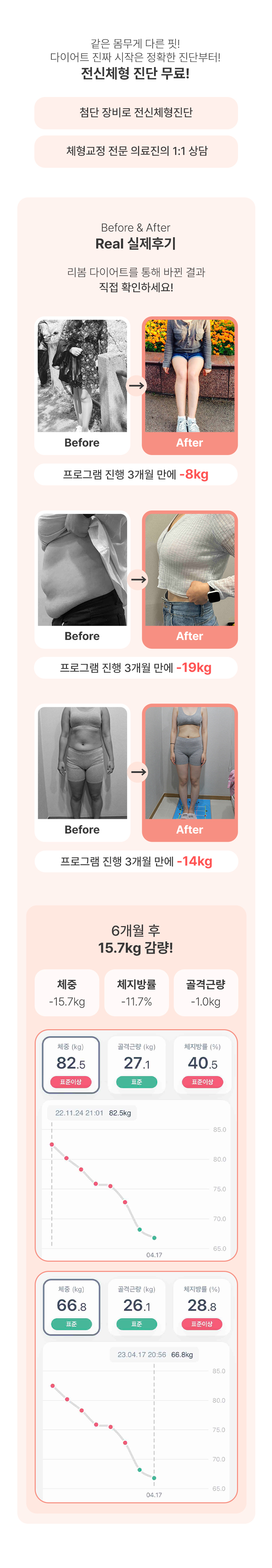 리봄한방병원 대구점 리봄 대구❤️지방박살패키지 1개월❤️ 이벤트, 시술 상세 이미지