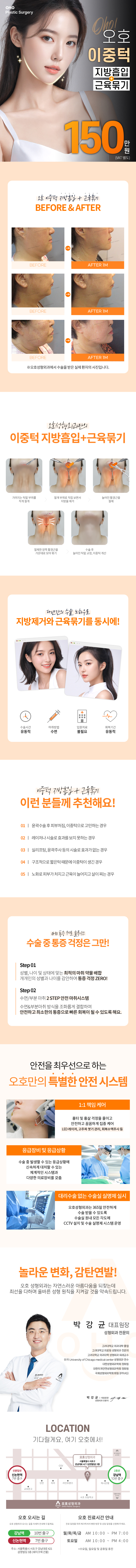 오호성형외과의원 오호 이중턱 지방흡입&근육묶기 이벤트, 시술 상세 이미지