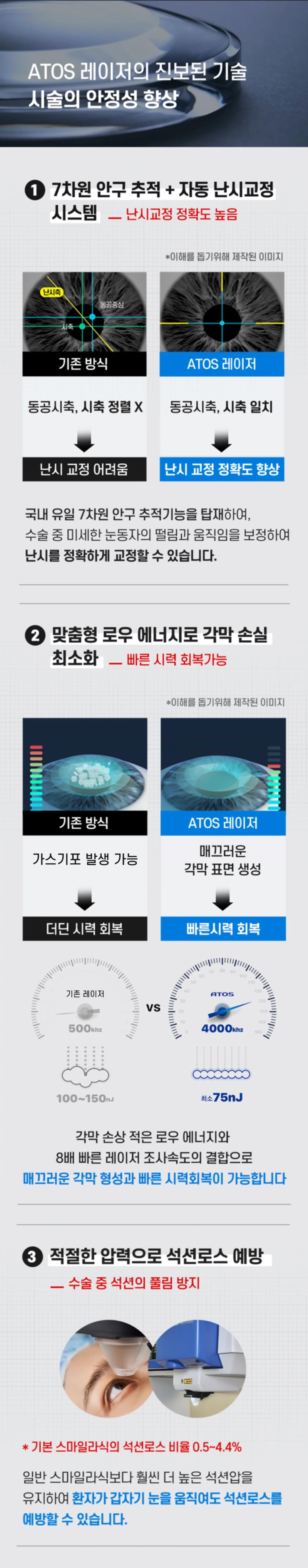 강남이오스안과의원 사이드컷 없는 스마일라식  이벤트, 시술 상세 이미지