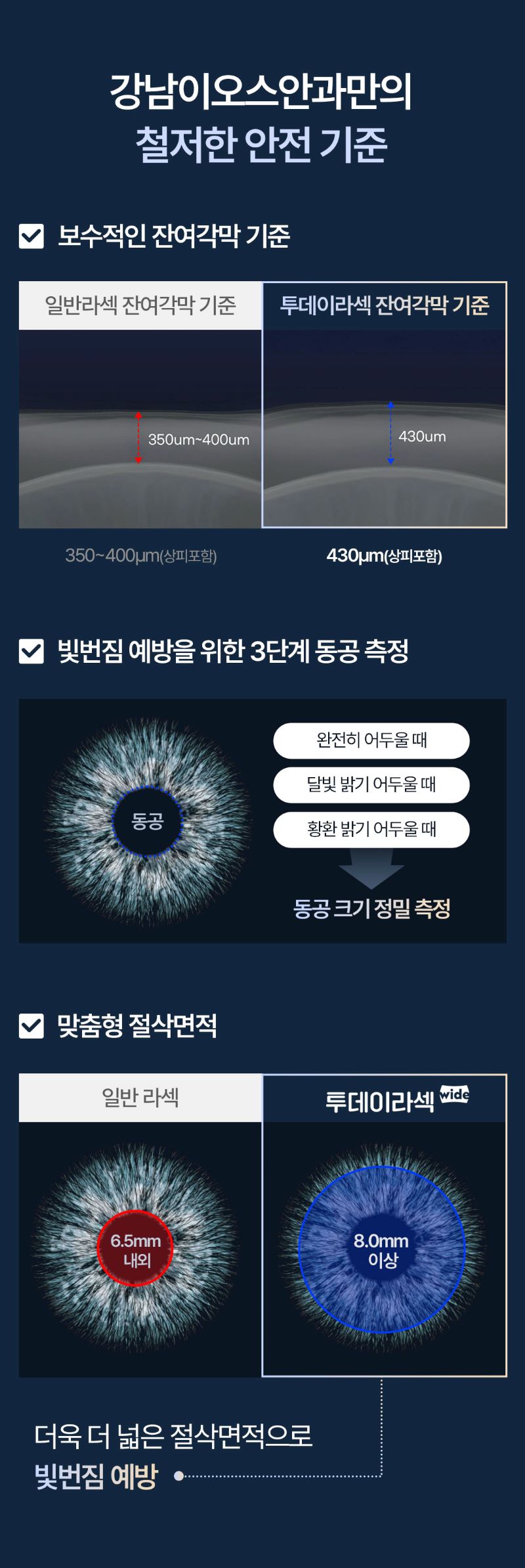 강남이오스안과의원 15년 연구 성과, 맞춤형 투데이라섹 이벤트, 시술 상세 이미지
