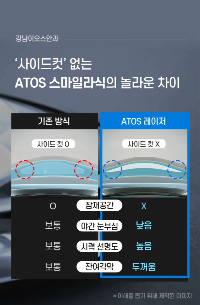 강남이오스안과의원 사이드컷 없는 스마일라식  이벤트, 시술 상세 이미지