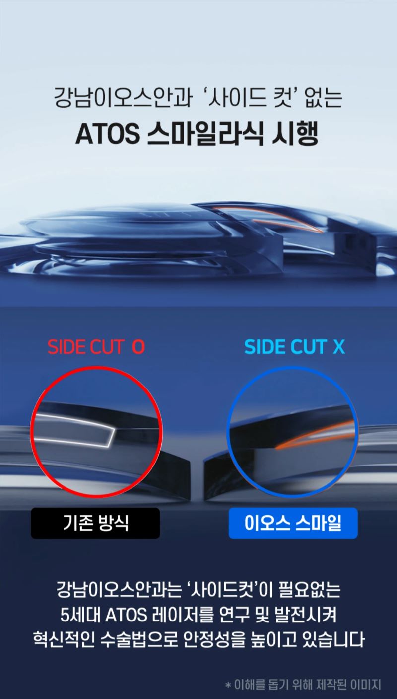 강남이오스안과의원 사이드컷 없는 스마일라식  이벤트, 시술 상세 이미지
