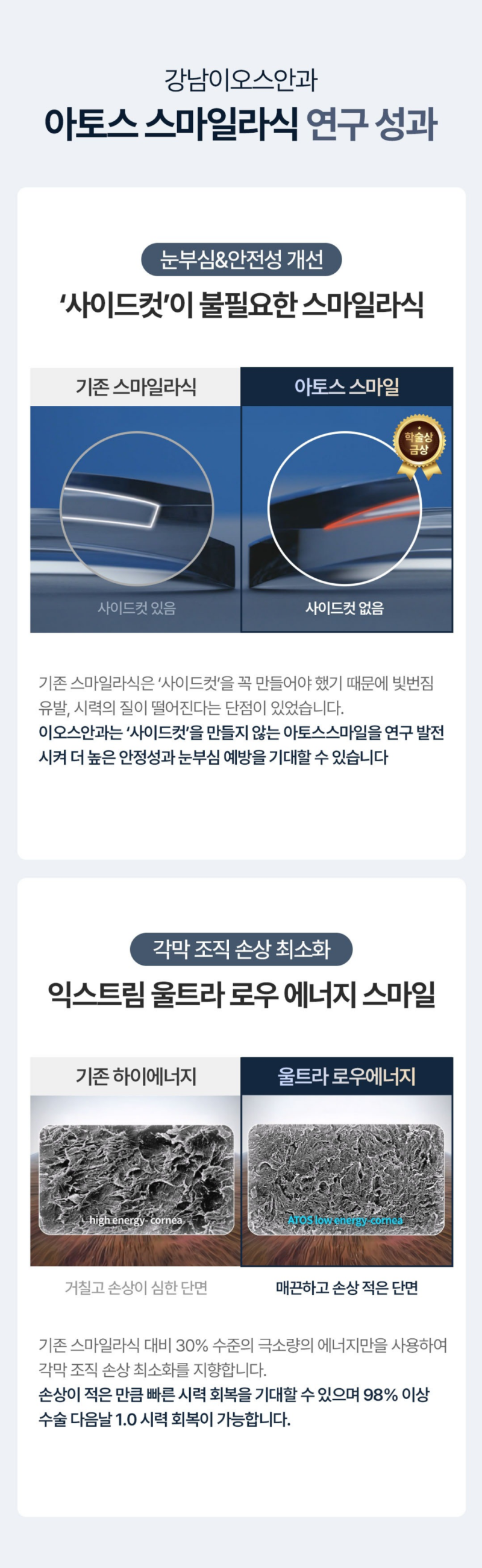 강남이오스안과의원 스마일라식 학술상 수상 특가 이벤트, 시술 상세 이미지