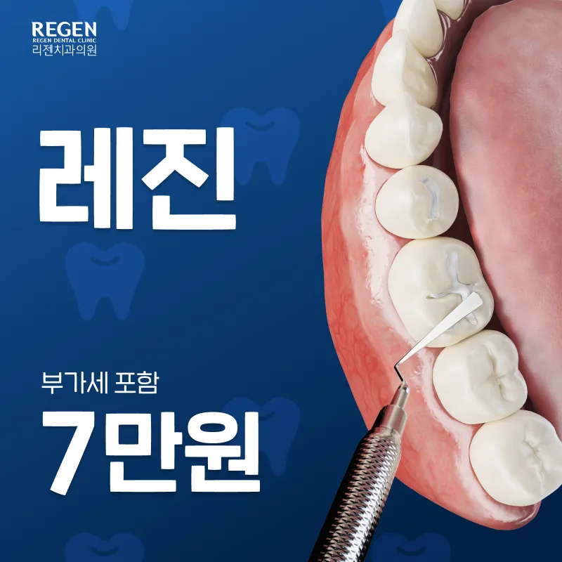 레진 7만원 이벤트 썸네일 이미지