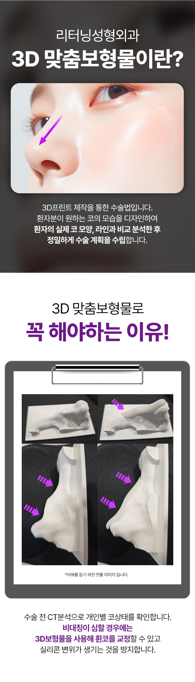 리터닝성형외과 리터닝3D핏미코맞춤보형물 이벤트, 시술 상세 이미지