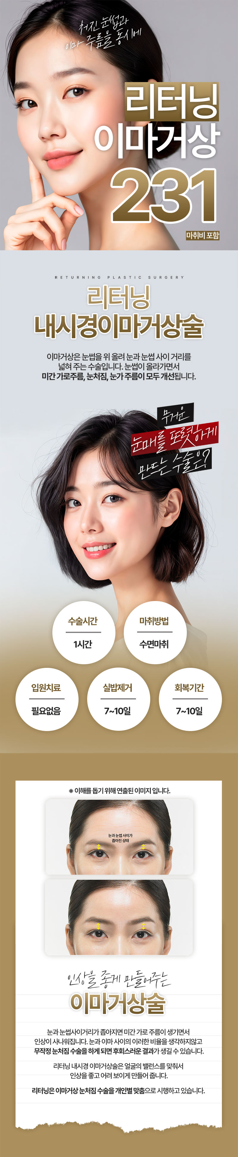 리터닝성형외과 리터닝 이마거상 이벤트, 시술 상세 이미지