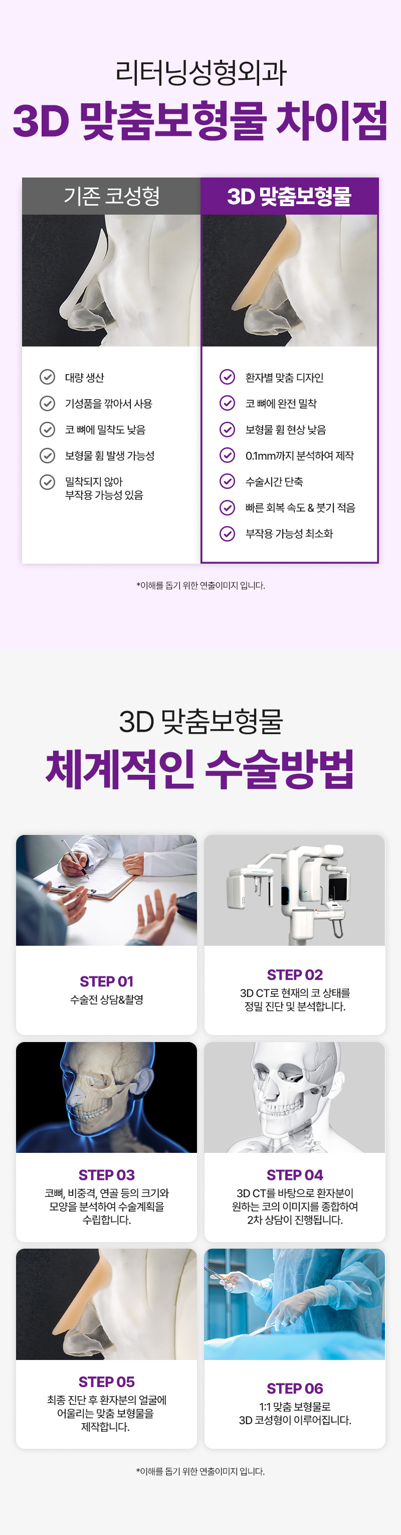 리터닝성형외과 리터닝3D핏미코맞춤보형물 이벤트, 시술 상세 이미지