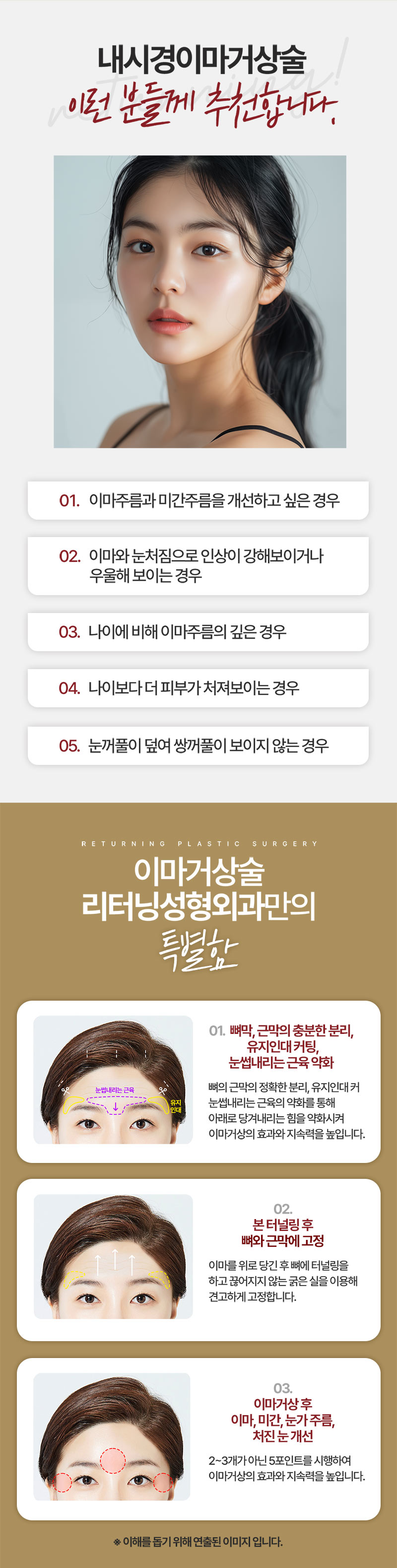 리터닝성형외과 리터닝 이마거상 이벤트, 시술 상세 이미지