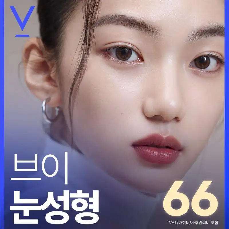 대구 브이 눈성형