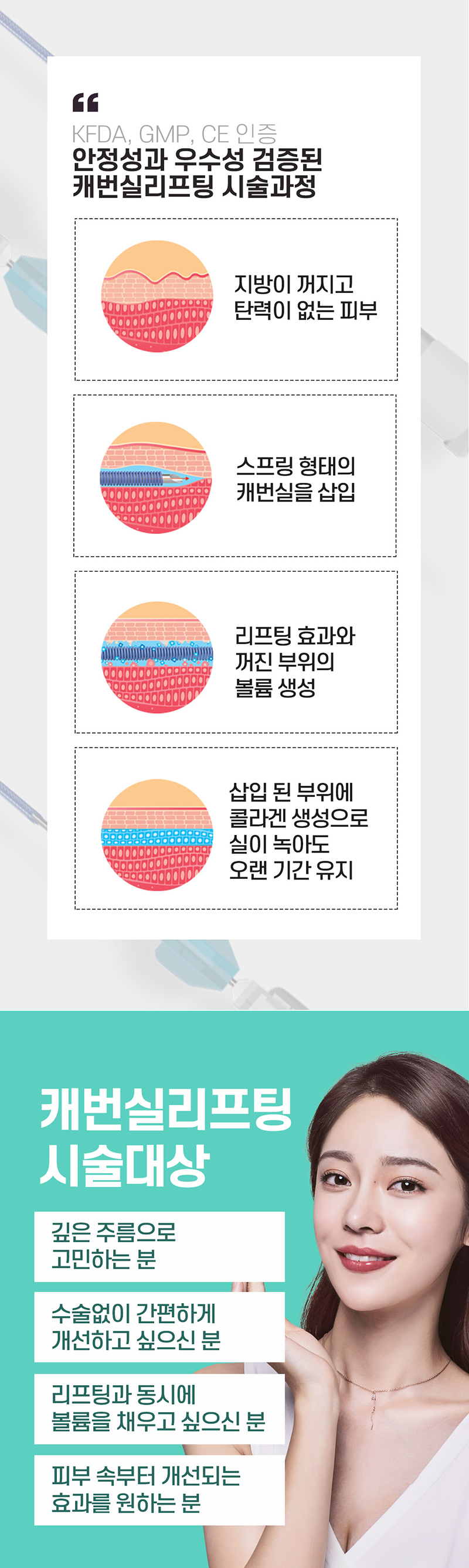 톱스타성형외과의원 광주 캐번실리프팅 이벤트, 시술 상세 이미지