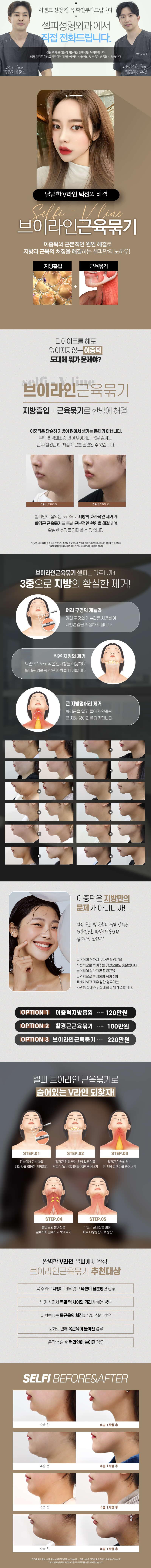 셀피성형외과의원 부산서면 ❤셀피_이중턱근육묶기❤ 이벤트, 시술 상세 이미지