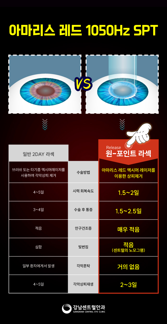 강남센트럴안과의원 1.5일 회복속도, 원포인트 라섹 이벤트, 시술 상세 이미지