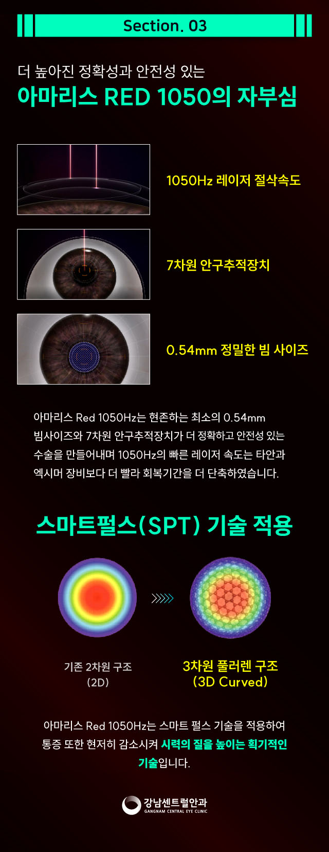 강남센트럴안과의원 1.5일 회복속도, 원포인트 라섹 이벤트, 시술 상세 이미지