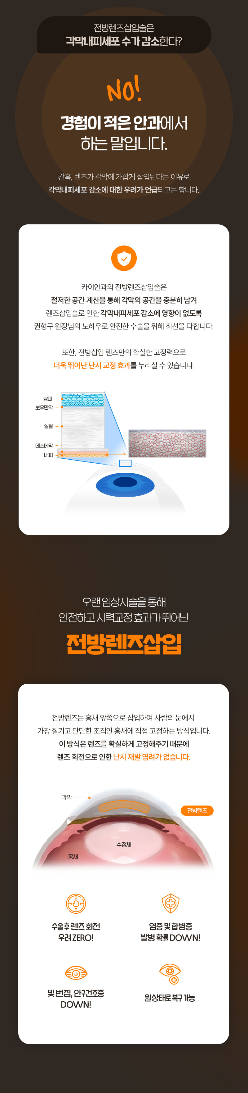 카이안과 가장 안전한 안내렌즈삽입술 이벤트, 시술 상세 이미지