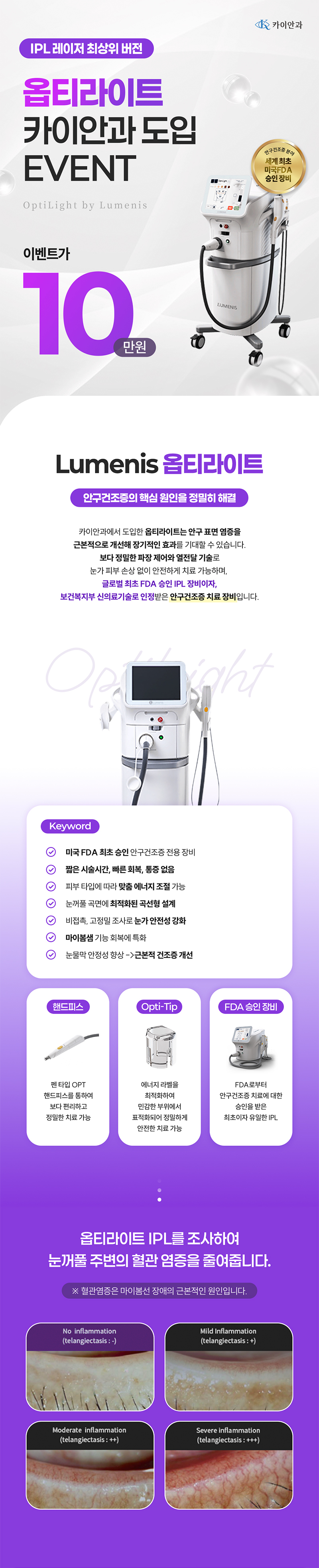 카이안과 안구건조증치료 할인 이벤트 이벤트, 시술 상세 이미지