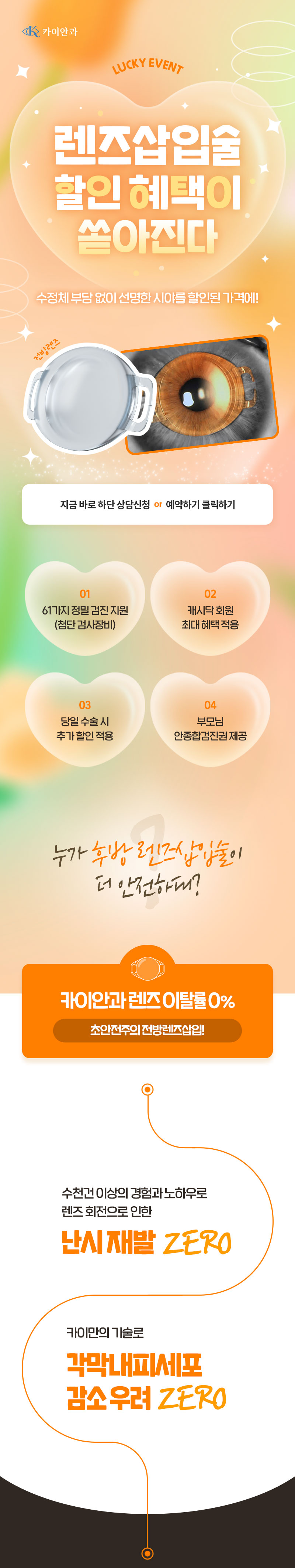 카이안과 가장 안전한 안내렌즈삽입술 이벤트, 시술 상세 이미지