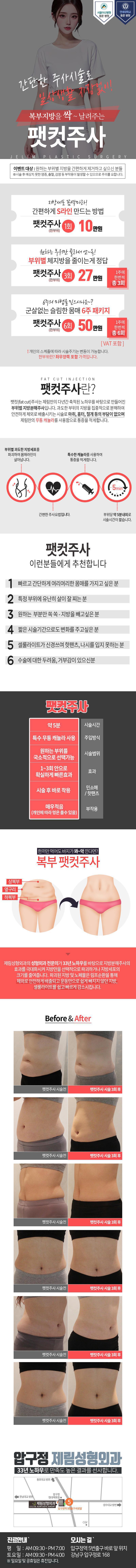 제림성형외과의원 복부지방 싹날려주는 팻컷 이벤트, 시술 상세 이미지