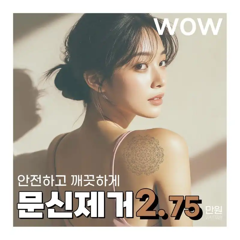 와우 문신제거
