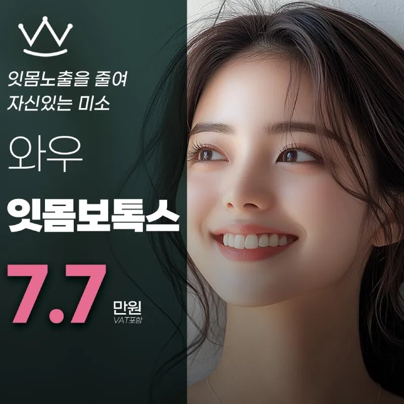 거미스마일 잇몸보톡스 이벤트 썸네일 이미지