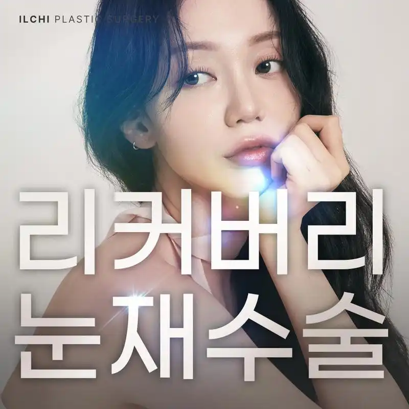 일치_리커버리 눈재수술