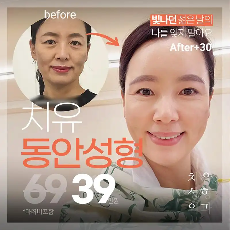 치유🌿중년동안모음zip