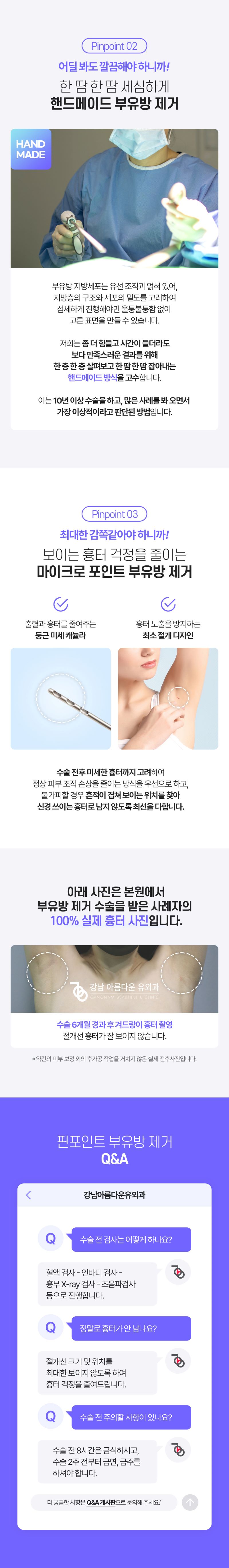 강남아름다운유외과의원 겨드랑이 부유방 핀포인트 제거 이벤트, 시술 상세 이미지