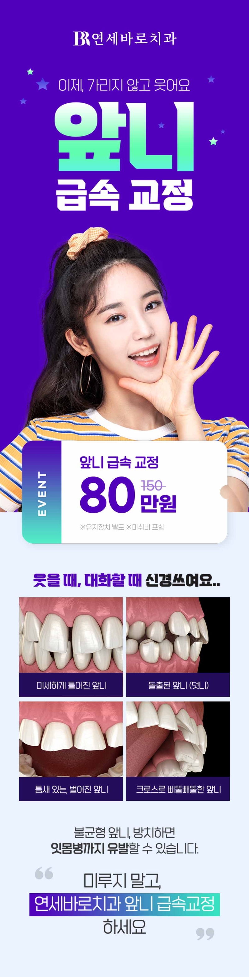 연세바로치과의원 압구정점 연세바로-앞니급속교정 이벤트, 시술 상세 이미지