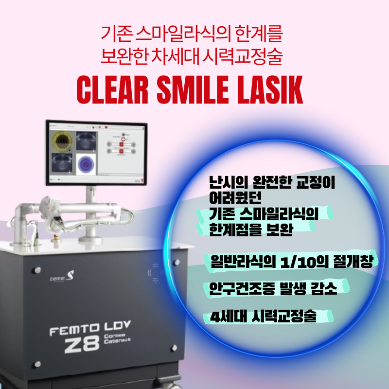 강남아이오케이안과 투데이라섹!!스마일라식!!할인이벤트 이벤트, 시술 상세 이미지
