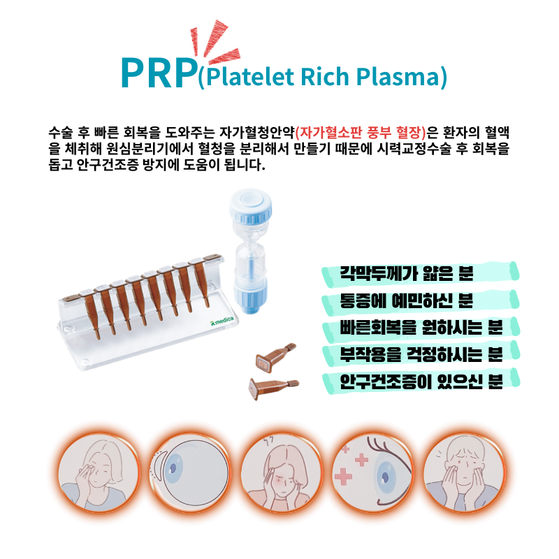 강남아이오케이안과 투데이라섹!!스마일라식!!할인이벤트 이벤트, 시술 상세 이미지