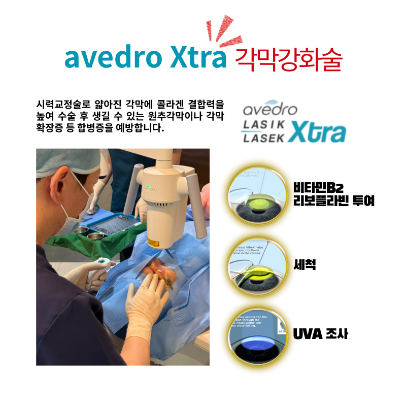 강남아이오케이안과 투데이라섹!!스마일라식!!할인이벤트 이벤트, 시술 상세 이미지