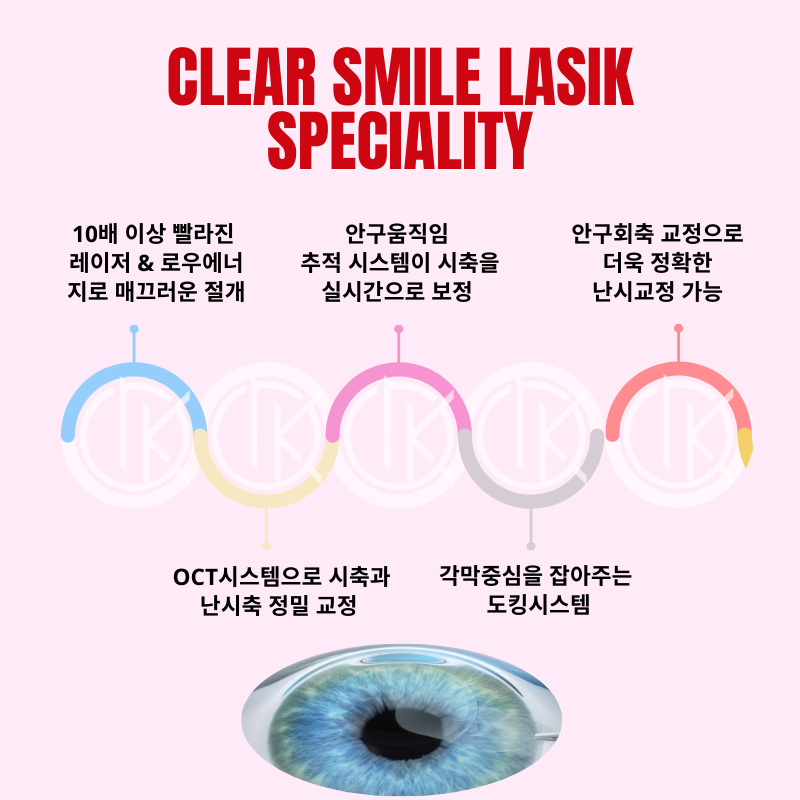 강남아이오케이안과 투데이라섹!!스마일라식!!할인이벤트 이벤트, 시술 상세 이미지