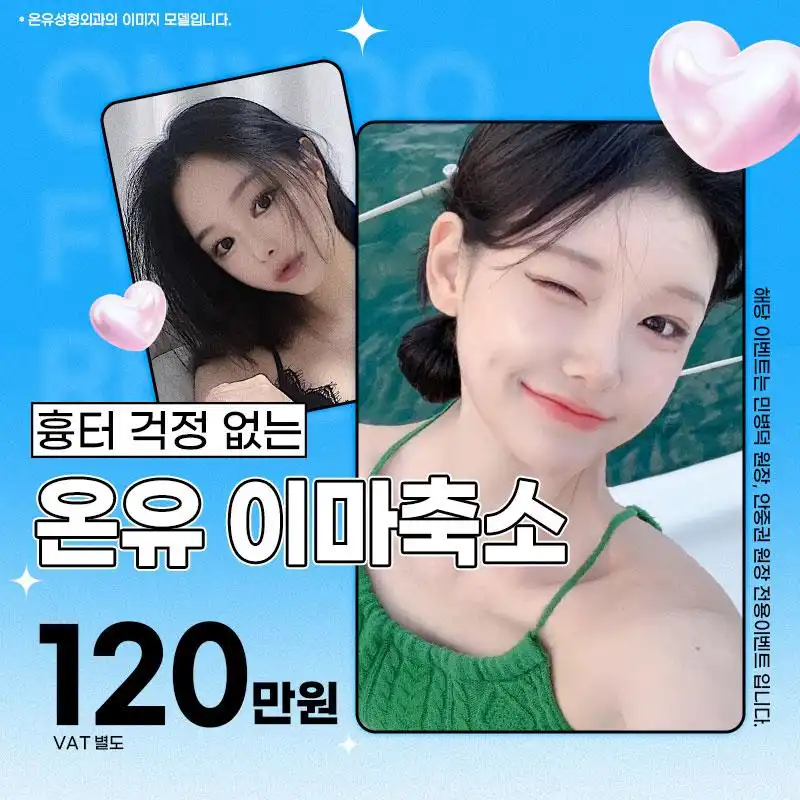 흉터 걱정 없는 이마축소