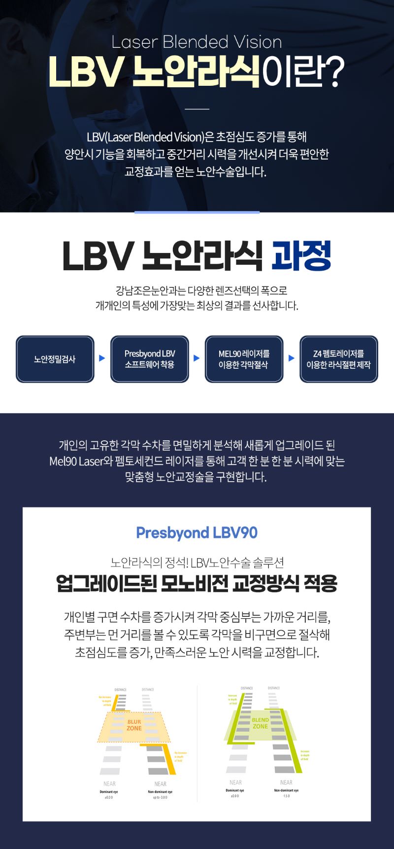 강남조은눈안과의원 LBV 노안라식 이벤트, 시술 상세 이미지