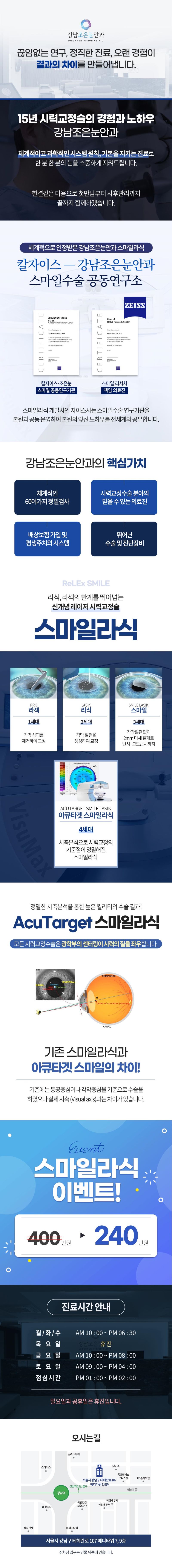 강남조은눈안과의원 스마일라식 이벤트, 시술 상세 이미지