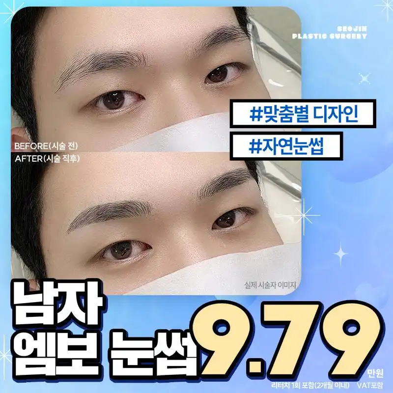 서진 남자엠보눈썹반영구