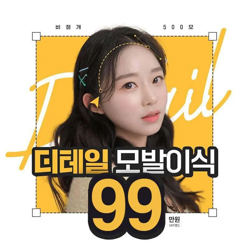 비절개 헤어라인 모발이식 이벤트 썸네일 이미지