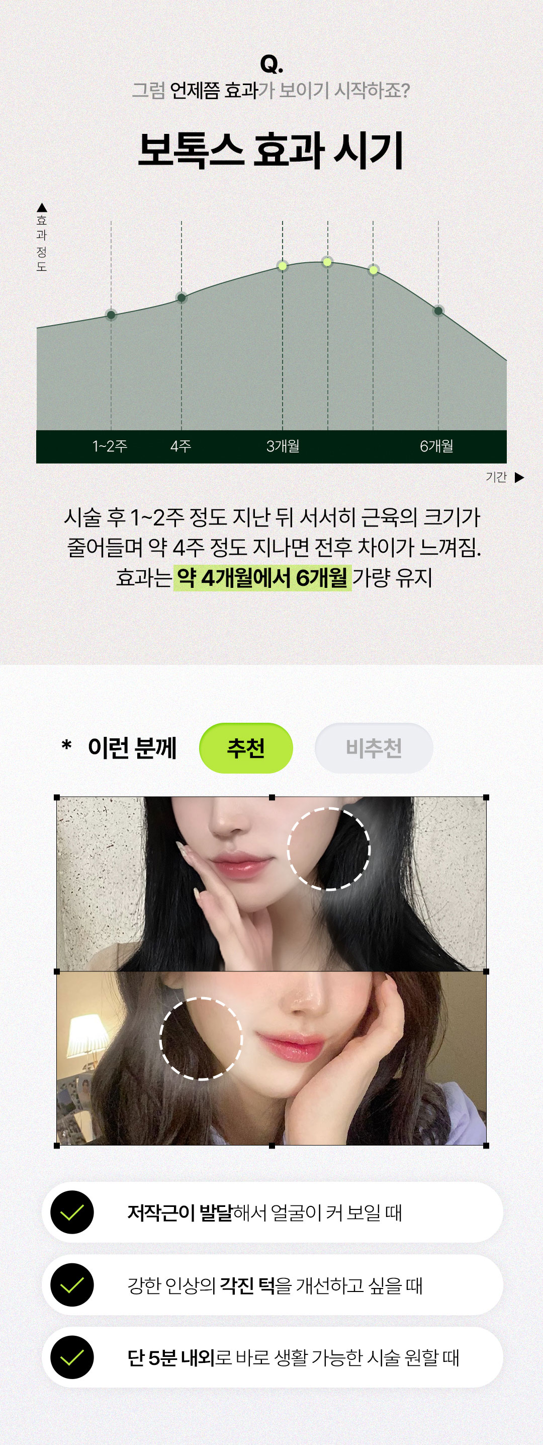 세이예스의원 사각턱보톡스 _v라인 이벤트 이벤트, 시술 상세 이미지