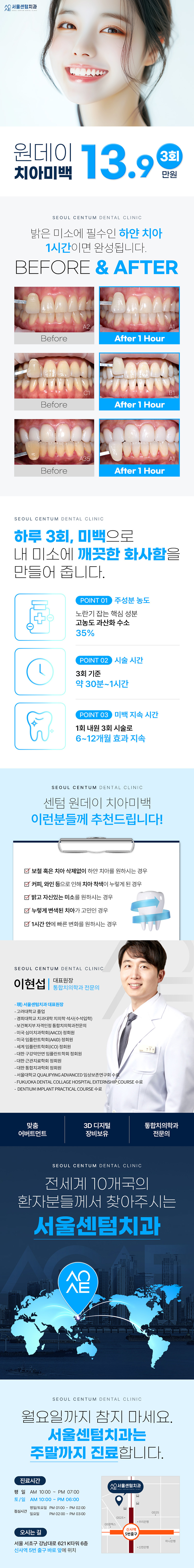 서울센텀치과의원 하루에 끝내원데이치아미백 3회 패키지 이벤트, 시술 상세 이미지