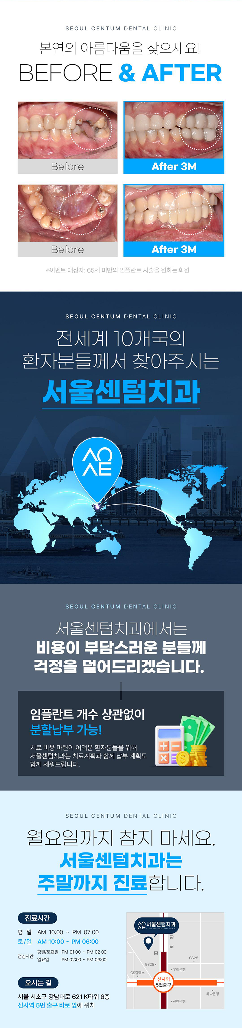 서울센텀치과의원 당일식립 가능한 오스템 임플란트 이벤트, 시술 상세 이미지